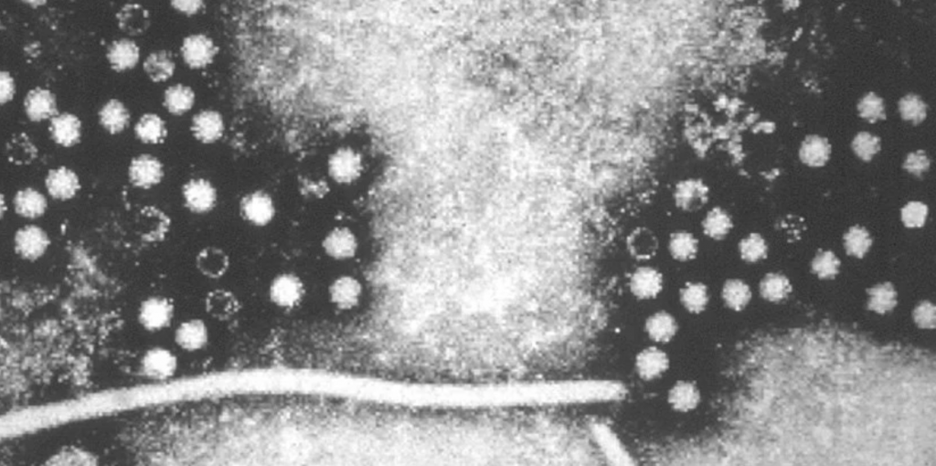 RNA virus